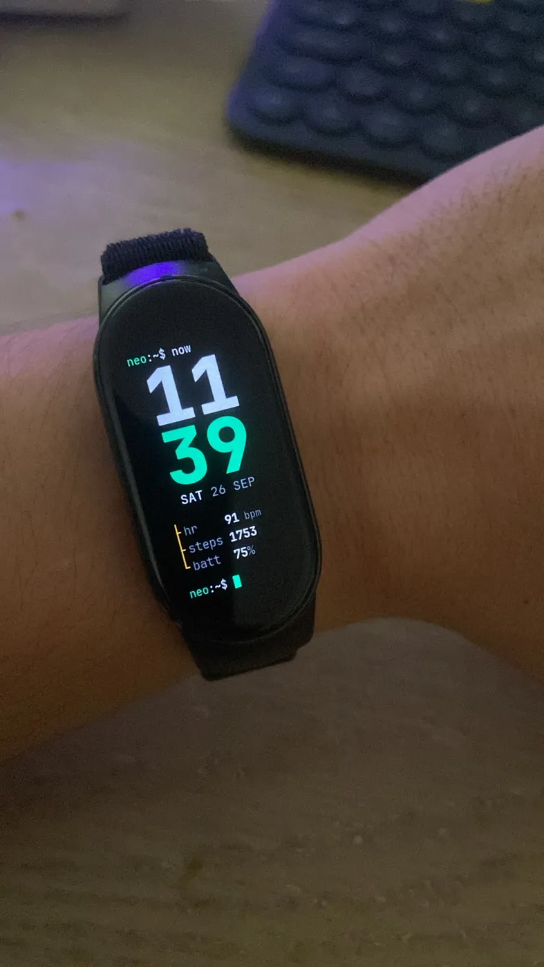 Custom terminal-themed Xiaomi Smart Band 10 watch face on my wrist